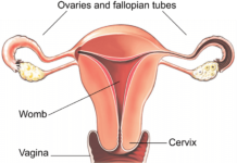 laparoscopic hysterectomy surgery