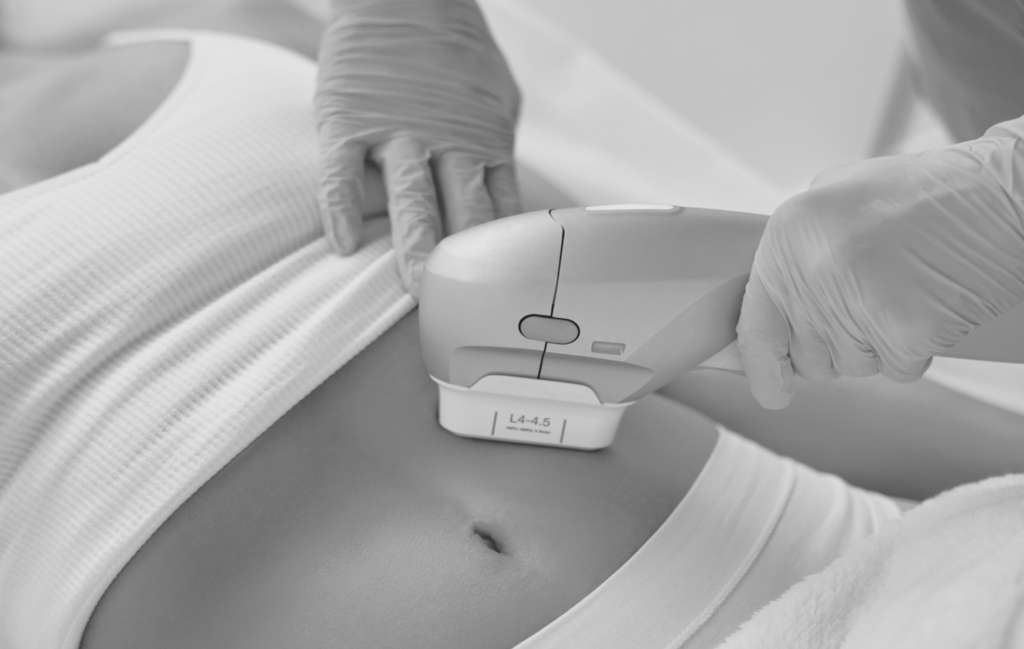 Preparing for CoolSculpting