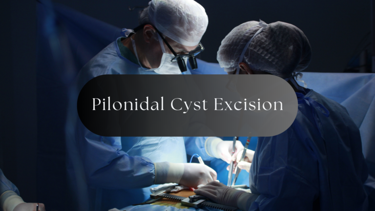 When Is Surgery Best for Pilonidal Cyst Treatment?