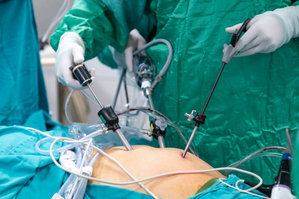 Exploring Bariatric Surgery Options